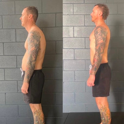 Instant Posture Corrector